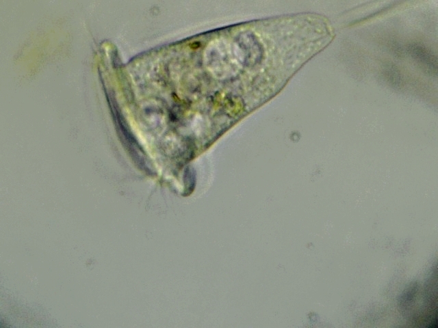 vorticella